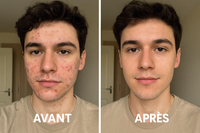 met lui mes patch anti boutons sur le avant et fais si ca avais ete pris avec son tel